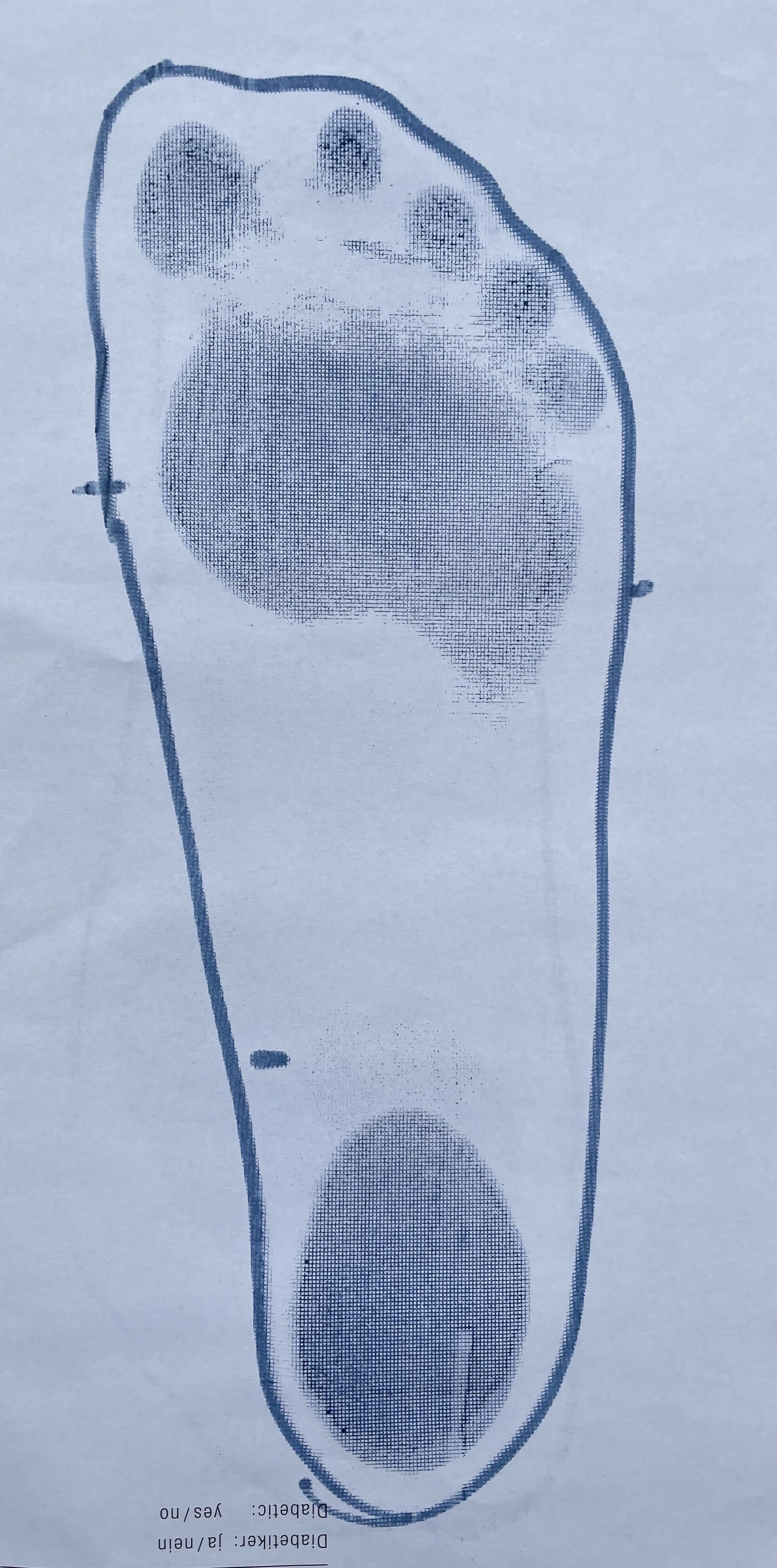 Schuhe und Einlagen bei Hohlfuß schuhschule.de